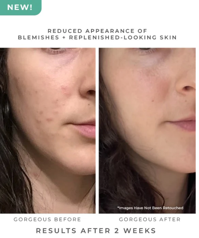 Oasis Deep Pore Gel Cleanser