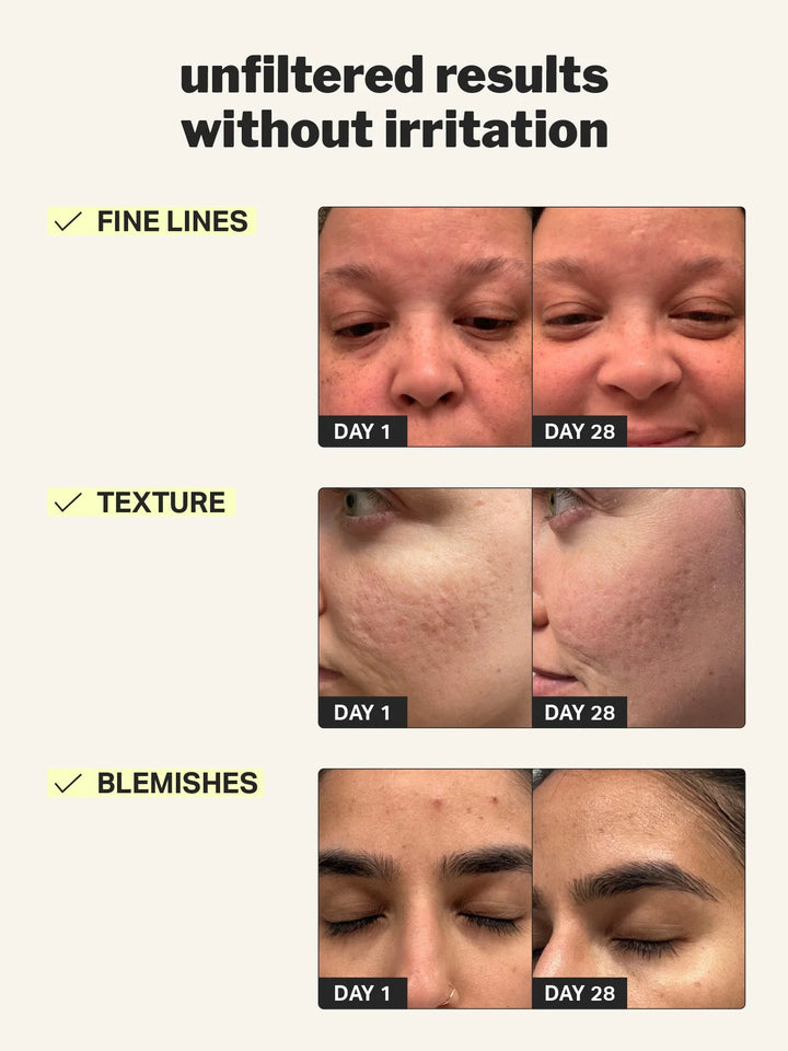 Beginner Retinol Gel 0.1%
