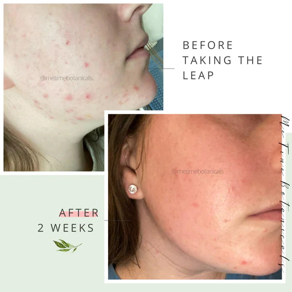 Glow Getter Vitamin C Retinol Serum