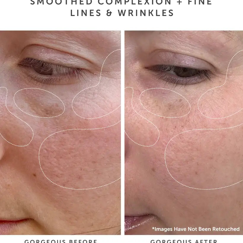 Anchor Bio-Retinol Vitality Serum