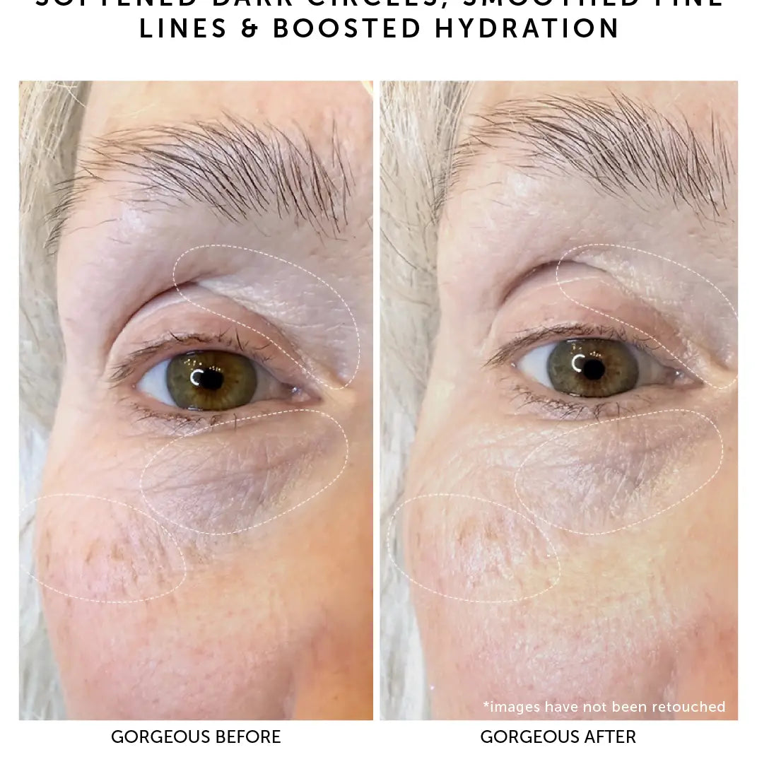 Isla Bio-Retinol Youth Eye Serum