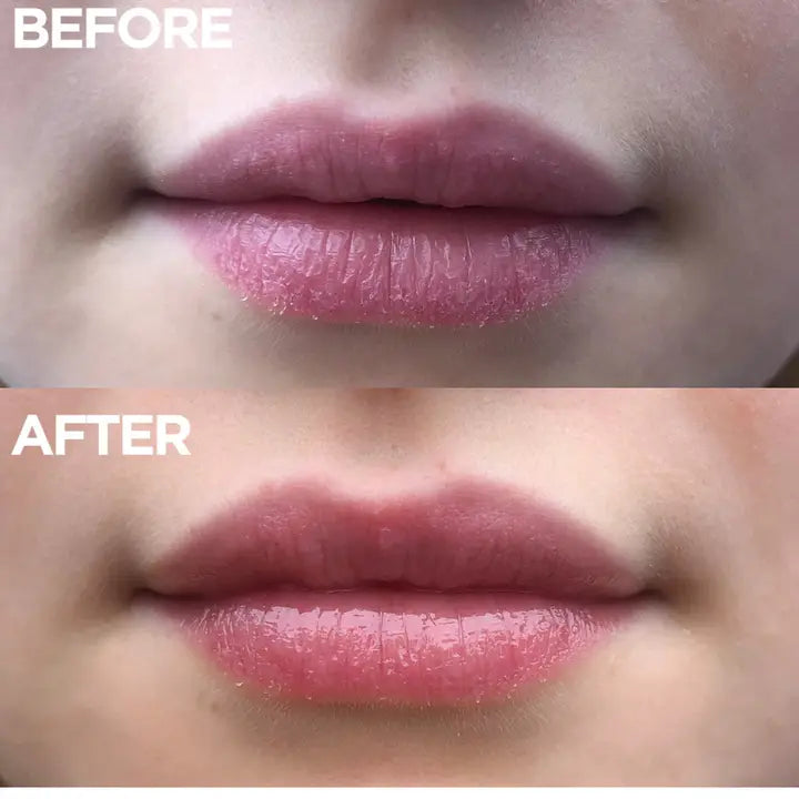 Lanolips | Ointment Multi-Balm