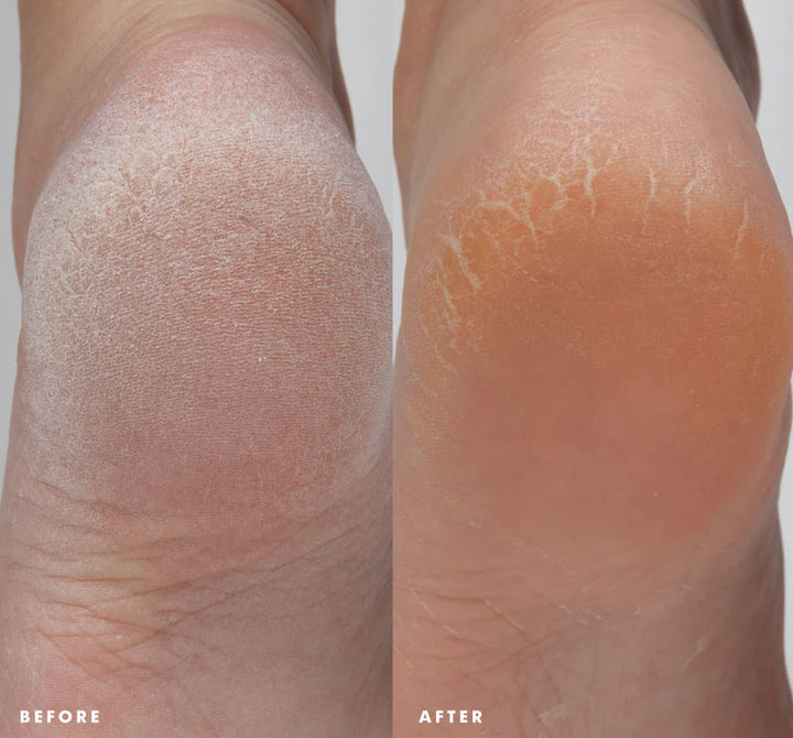 Farmhouse Fresh | Enrich Mint® Foot Rescue Mask