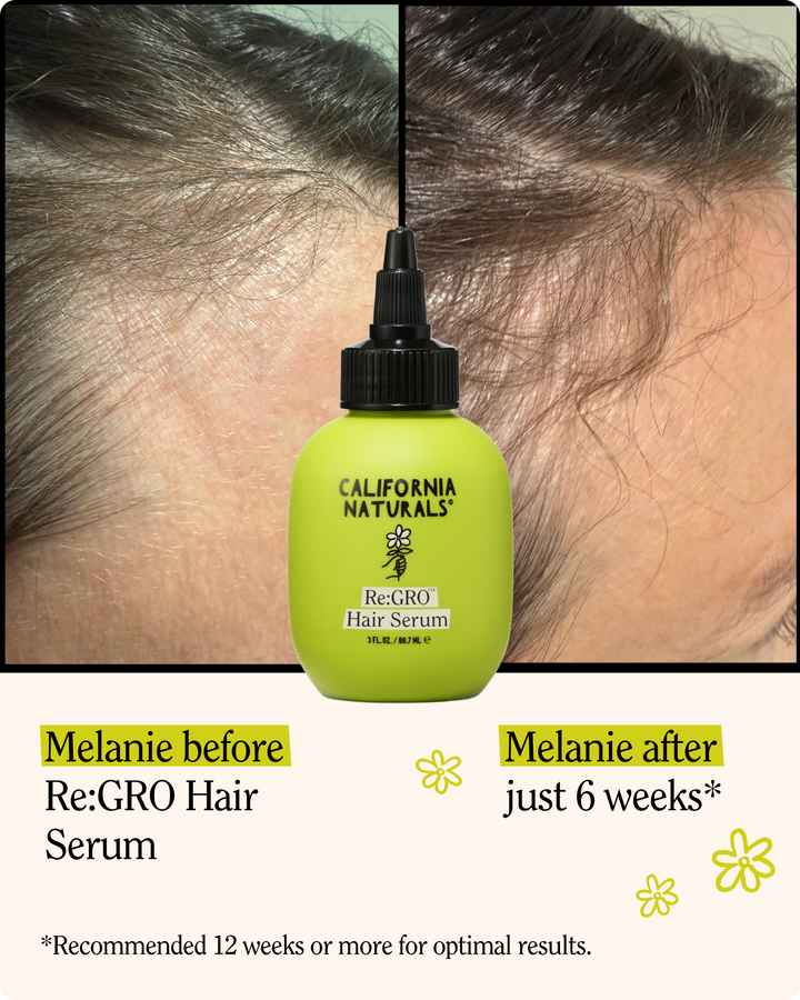Re:GRO Anti- Thinning Scalp Serum
